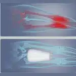 ORTHOPILLOW58055__c540a67e