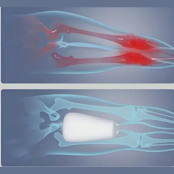 ORTHOPILLOW23432__5482a94f__130625-1