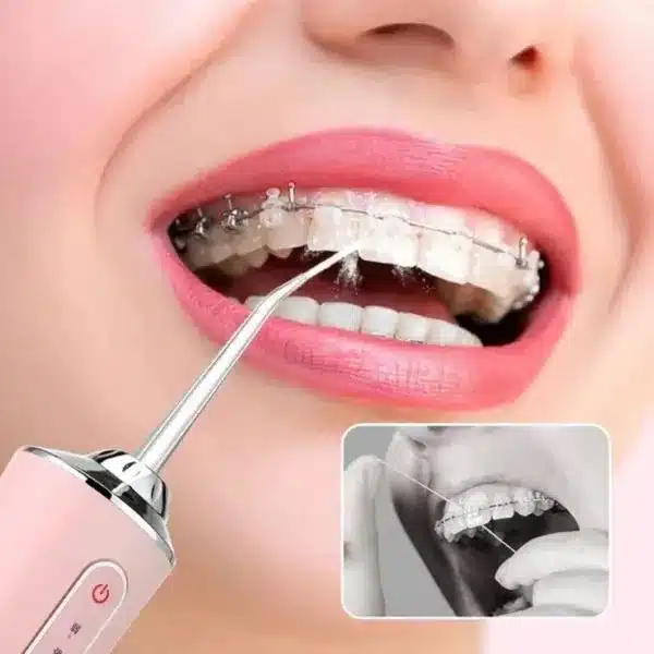 TOOTHCLEANSO24175__0a6837c0__130625